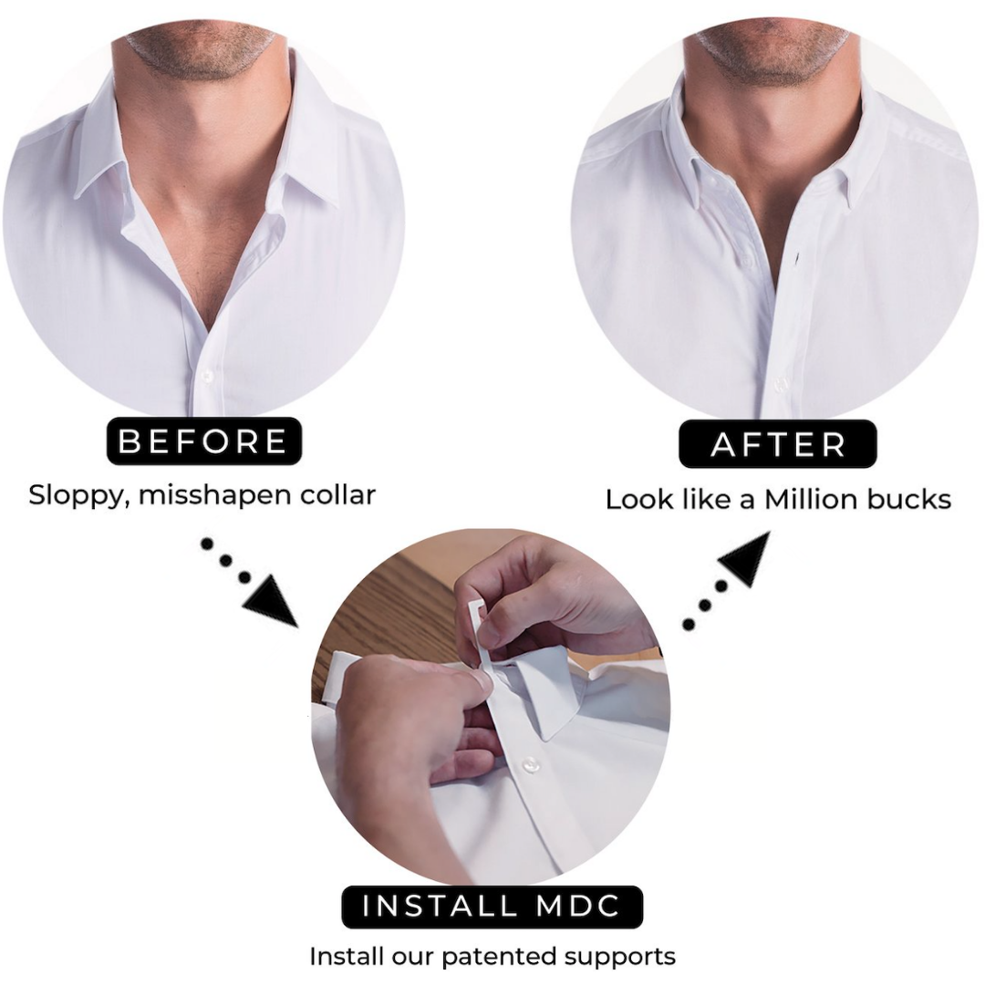 Million Dollar Collar | Placket Stays